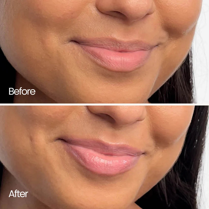Vermoni® True Tone Lipstick